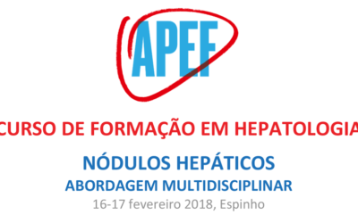 Curso de Formação em Hepatologia: Nódulos hepáticos – abordagem multidisciplinar