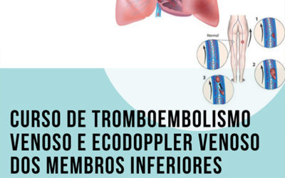 Curso de Tromboembolismo Venoso e Ecodoppler Venoso dos Membros Inferiores – Inscrições Abertas